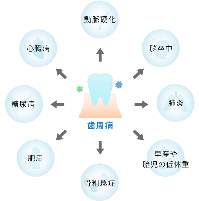 歯周病は身体全体の病気と関連しています